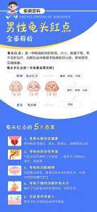 名单更新:医院靠谱吗-排行总榜发布-割包皮哪家医院较好