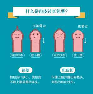 专业解答：南昌看阳痿的专科医院-南昌看阳痿的医院好不好？